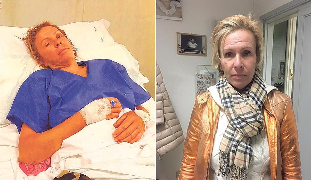 Natalia Khoklova il giorno del ricovero in ospedale e mentre ci racconta dell’aggressione subita