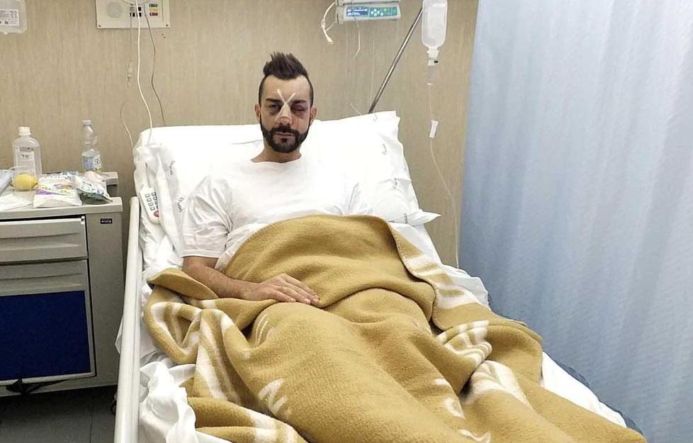 Preso a pugni dal compagno della ex 