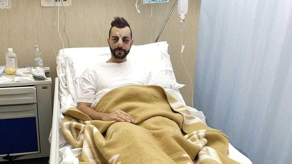 Preso a pugni dal compagno della ex