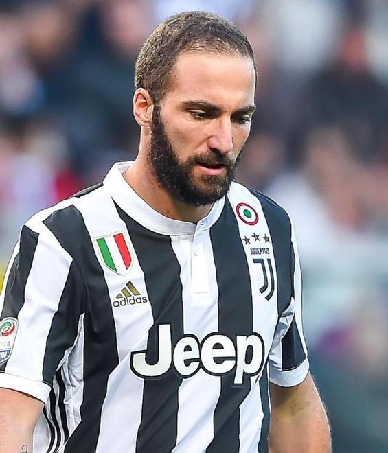 La Juventus alle prese con il dubbio Higuain