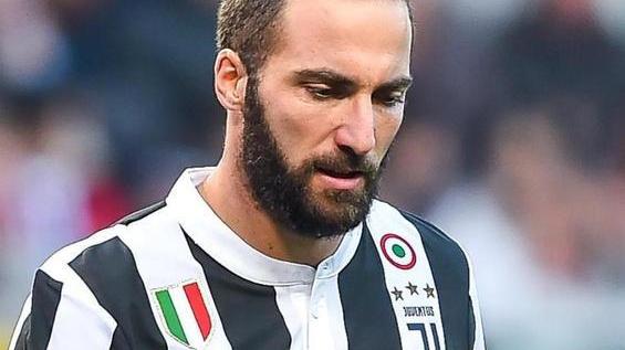 La Juventus alle prese con il dubbio Higuain