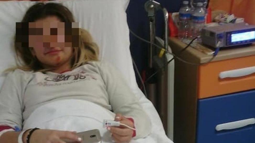 Bambina investita da un’auto pirata
