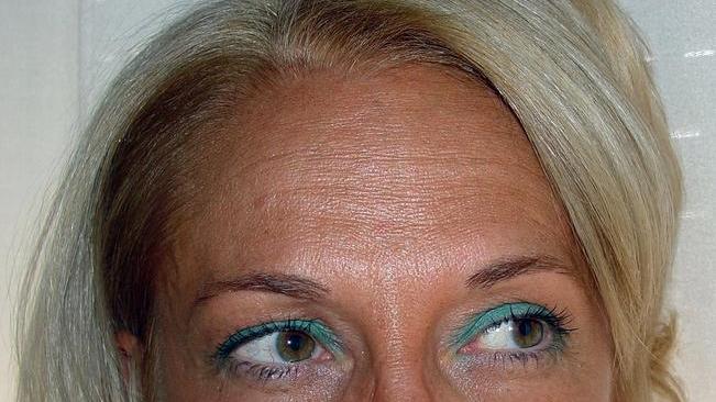 Fuori pericolo i due figli dell’infermiera morta nel rogo