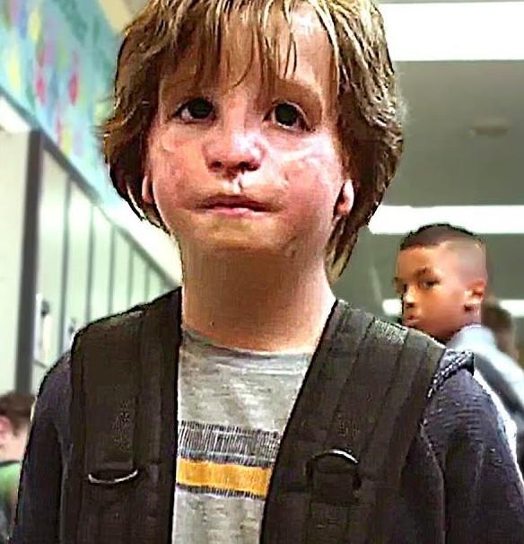 “Wonder”, il coraggio del piccolo Auggie
