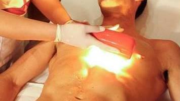 La depilazione con lesioni finisce dal giudice di pace