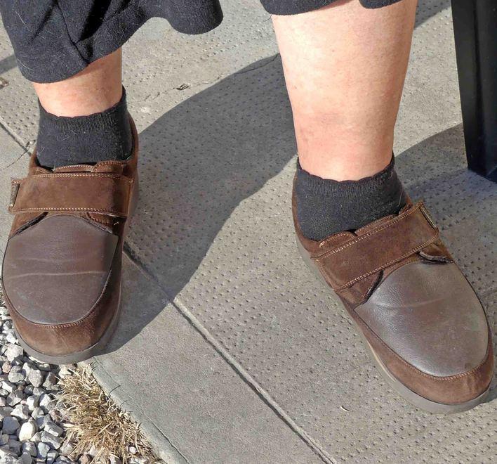 Ammalata di diabete ora deve pagarsi le scarpe 