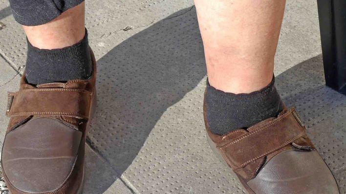 Ammalata di diabete ora deve pagarsi le scarpe