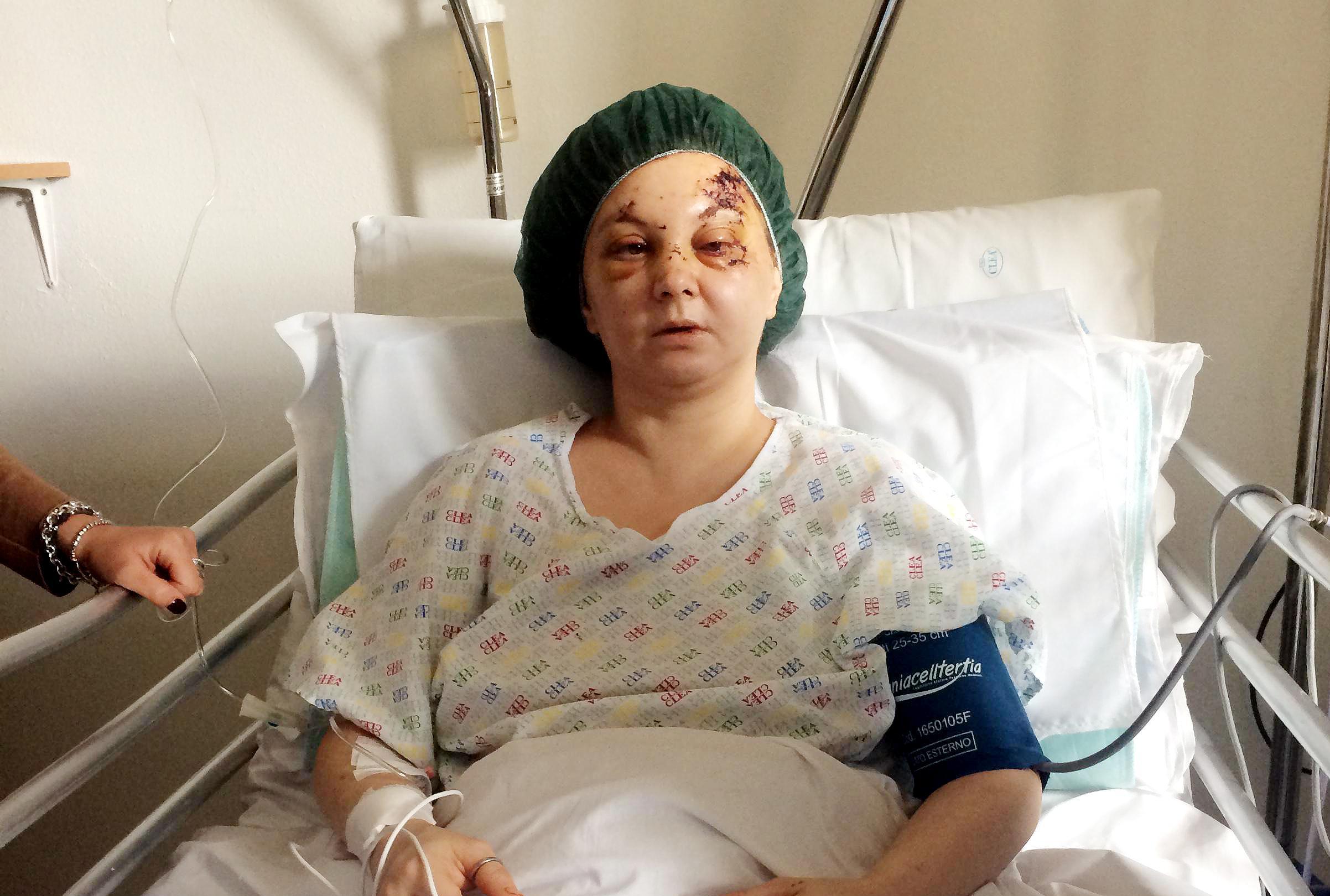 Martina Murgese, la 40enne massacrata di botte dal compagno a Macomer