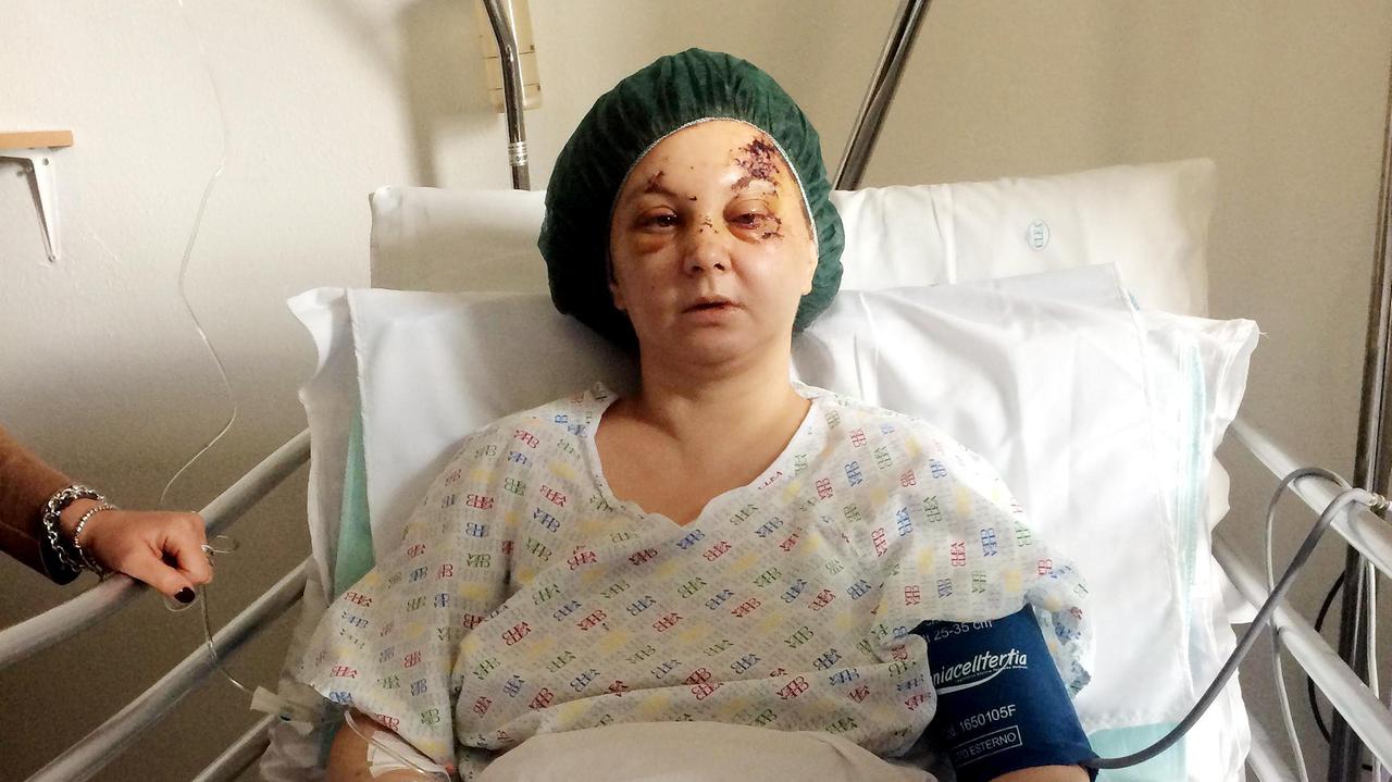 Martina Murgese, la 40enne massacrata di botte dal compagno a Macomer