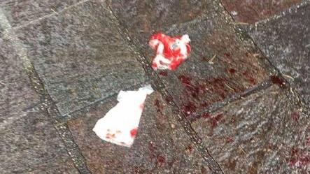 Sangue per terra davanti al bancomat: scatta l’allarme
