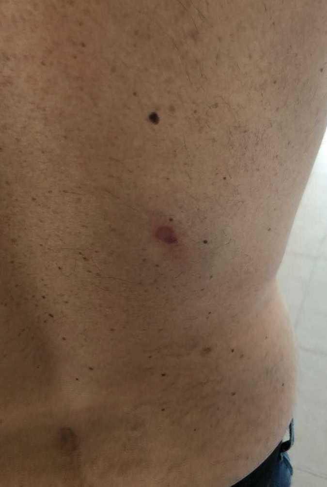 Aggredito un tifoso dell’Arzachena 