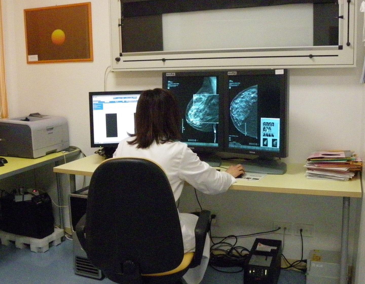 Mammografia impossibile 5 mesi per l’appuntamento 