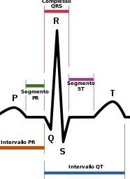 sindrome del qt lungo