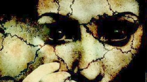 Alzheimer, non è soltanto una malattia per vecchi