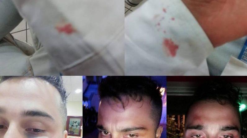 Due viareggini presi a calci e pugni fuori da una discoteca di Calcinaia