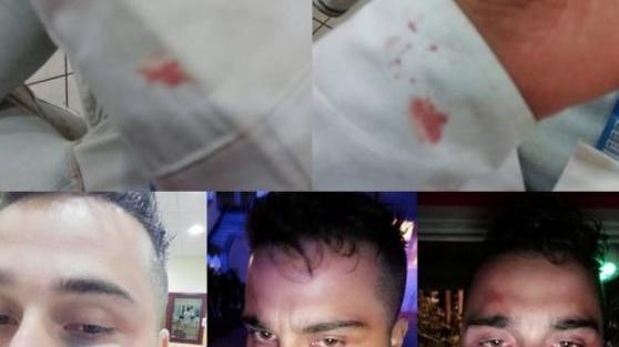 La rabbia del giovane picchiato dal branco: "Pestato a terra nell'indifferenza generale"