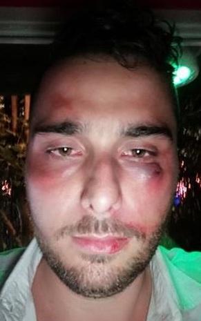 Picchiati per un brindisi in discoteca 