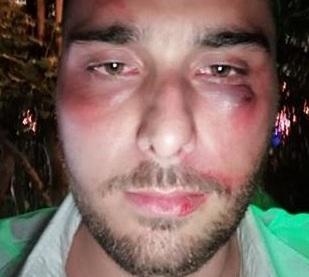 Caccia all’aggressore dei giovani viareggini 