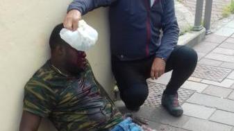 Un passante tampona la ferita al nigeriano ferito