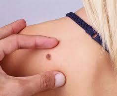 Il Cnr di Sassari in prima linea contro i tumori 