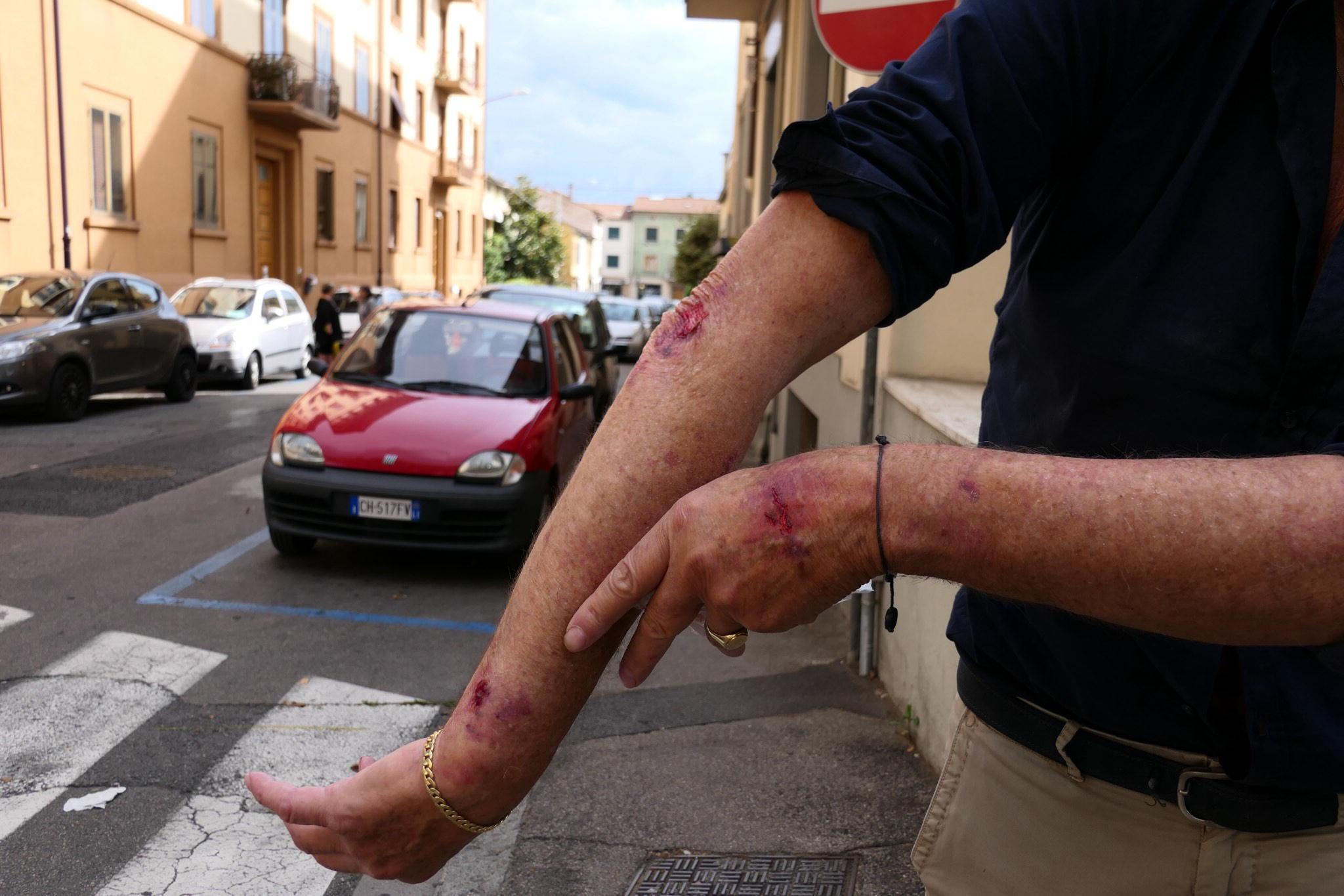 L'uomo mostra il braccio ferito dalla coppia che voleva rapinarlo (foto Sproviero/Batavia)