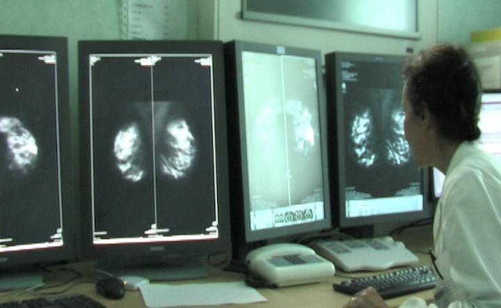 Cancro al seno, Lucca è avanguardia 