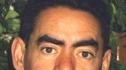 Aggredì cardiologo con acido: pena ridotta