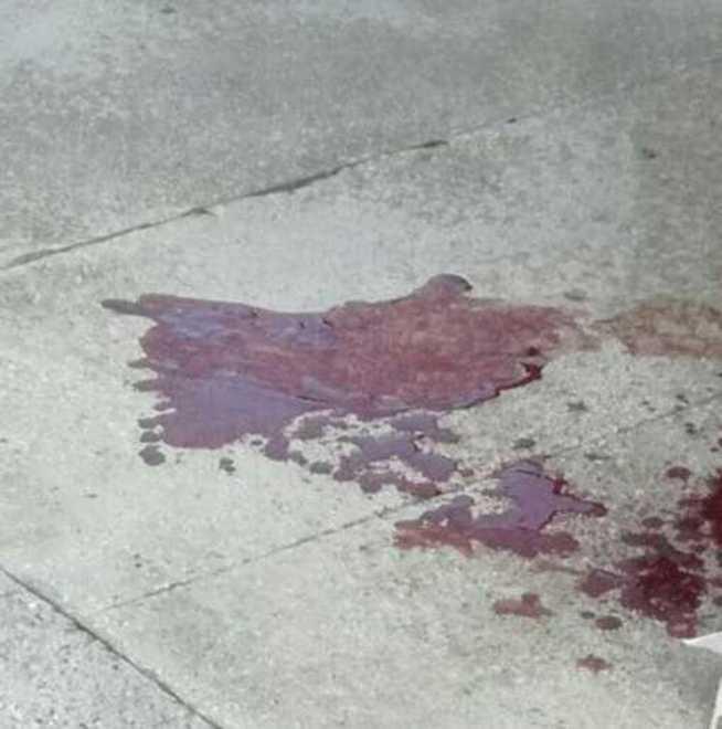 Carpi, le strappa la borsa e la scaraventa a terra, anziana all’ospedale 