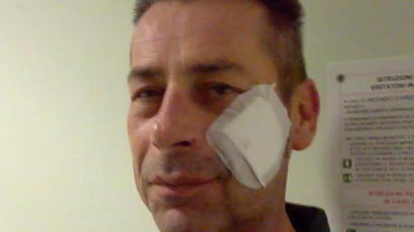 Condannato a otto anni di reclusione per l’aggressione all’ispettore di polizia