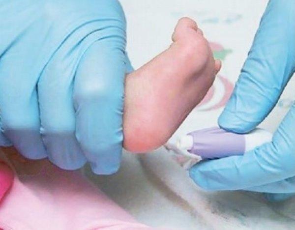 I+l campione viene prelevato dal tallone del neonato (foto d'archivio)