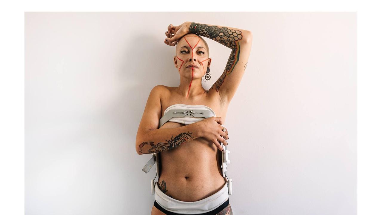 Difetti, cicatrici e pregiudizi: ecco le foto che mettono a nudo la bellezza interiore