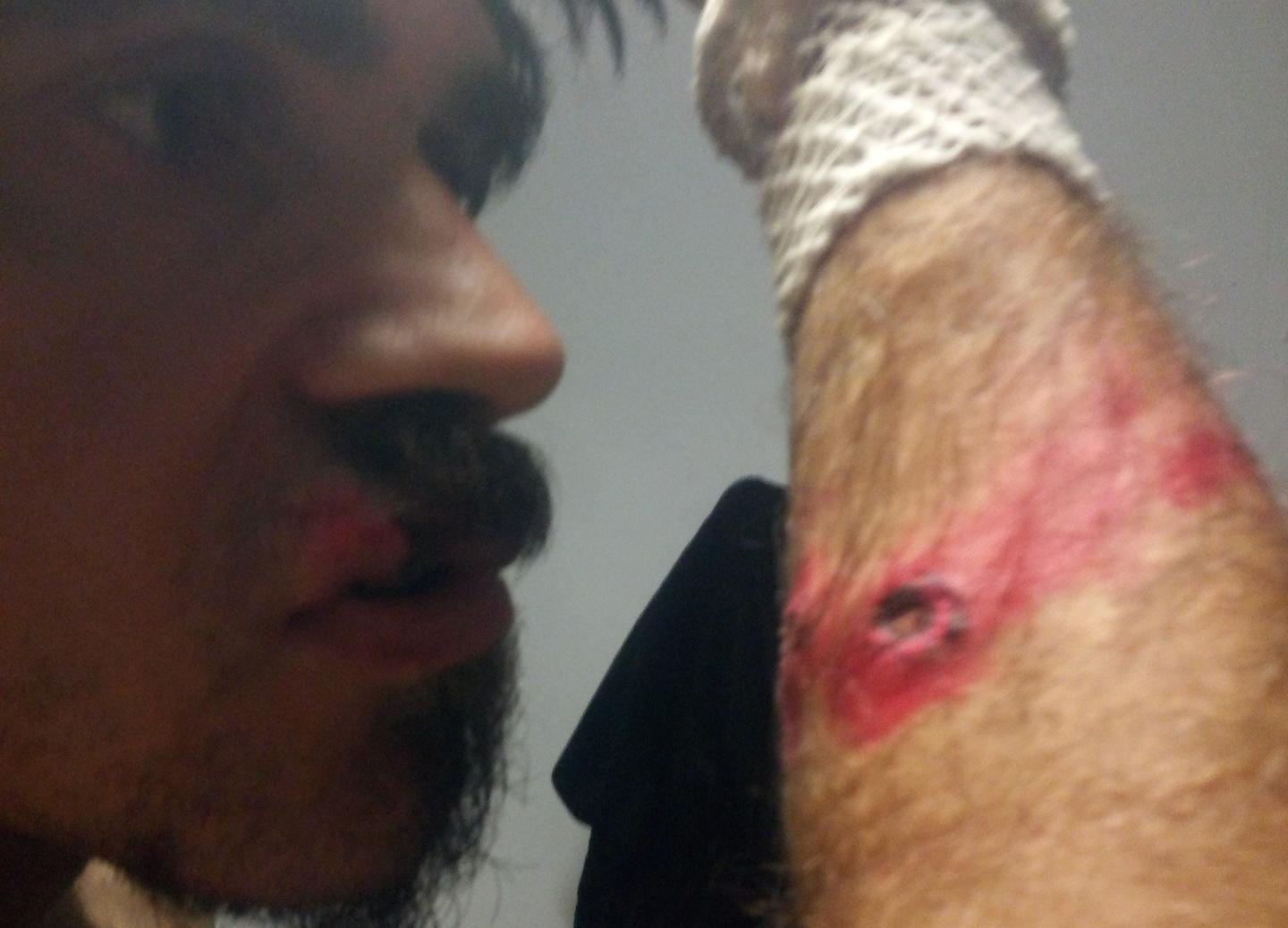 Ingegnere di Badesi ferito nell'inseguimento dei carabinieri: non è stato un proiettile