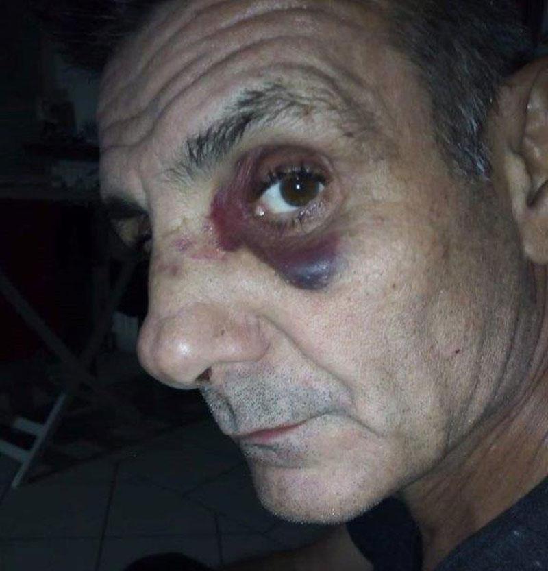 Picchiato dalla baby gang: «Fari accesi nel parco solo ora, c’è voluta la mia aggressione» 