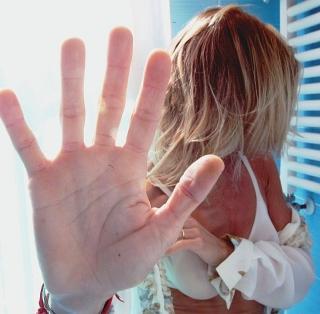 Violenza sulle donne,un gruppo di volontarie per aiutare le vittime