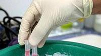 Rischio influenza A per una scolaresca di studenti tedeschi in gita in Versilia