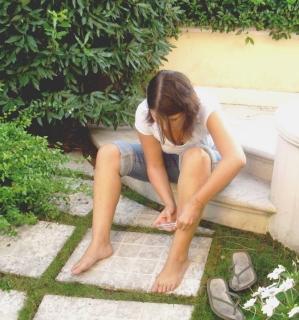Le due ragazze cavie umane nella lotta anti-zanzare Sotto: una di loro con le gambe martoriate delle punture
