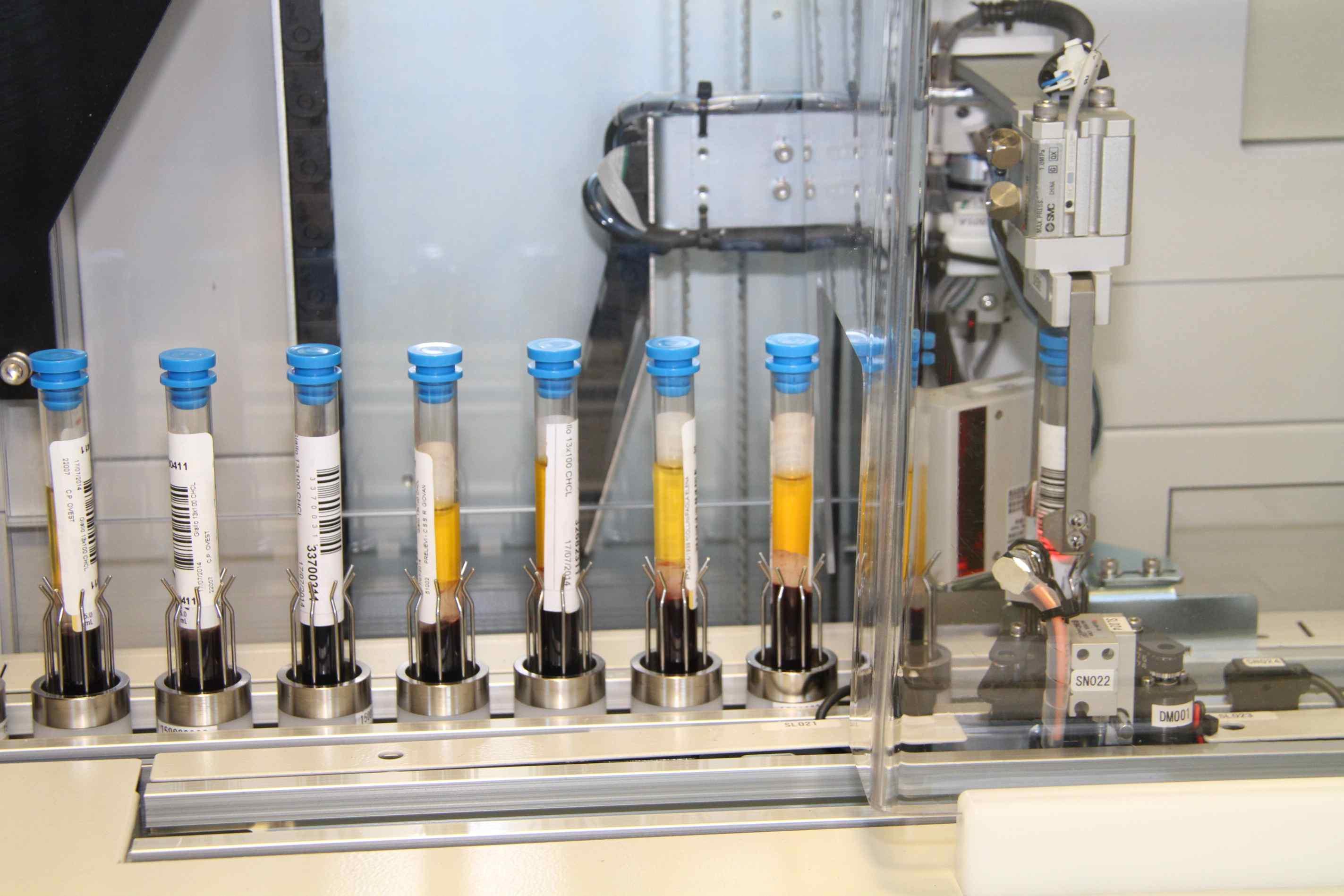 L'interno del laboratorio analisi dell'ospedale Santo Stefano