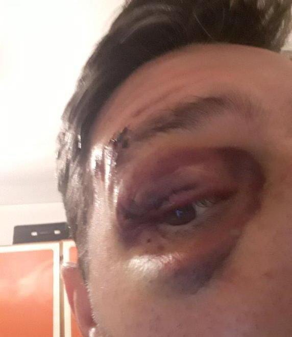 Morso da un cane attraverso un cancello «Nessuno mi aiuta»