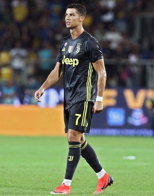 Juventus, bando alle polemiche Allegri: «Pensiamo a vincere» 