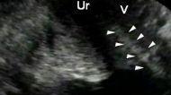 Trenta inseminazioni in 4 mesi