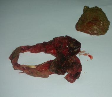 Polpette avvelenate 