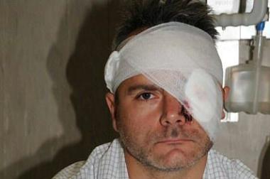 Sasha Lazzareschi in ospedale 