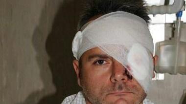 Sasha Lazzareschi in ospedale