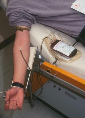 Un prelievo di sangue destinato alla donazione            