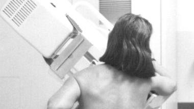 Un esame di mammografia al seno