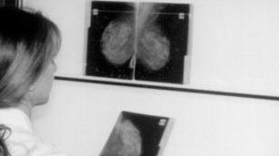 <b>REFERTI. </b>Un medico guarda i radiogrammi