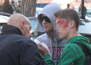 Uno dei ragazzi feriti e unimmagine del corteo degli studenti 