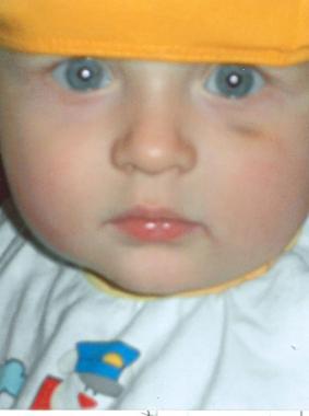  Tanti auguri a Matteo che oggi compie un anno. Da babbo Davide, mamma Ela, dal fratello Kevin ...