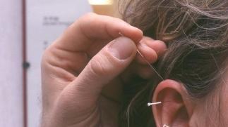 <b>AGOPUNTURA </b>Una delle medicine alternative praticate all’ospedale di Pitigliano