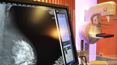 L’apparecchio per eseguire mammografie digitalizzate al Ceppo